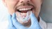 the difference between mouth guards and night guard