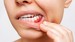 Why High Blood Sugar Triggers Gum Disease