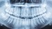 What Are Premolars?