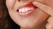 What Do Dentists Do If You Have Periodontal Disease?